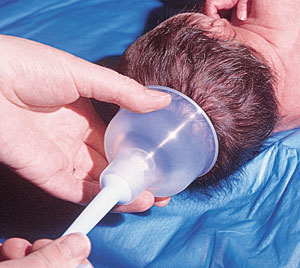 دستگاه وکیوم در پزشکی