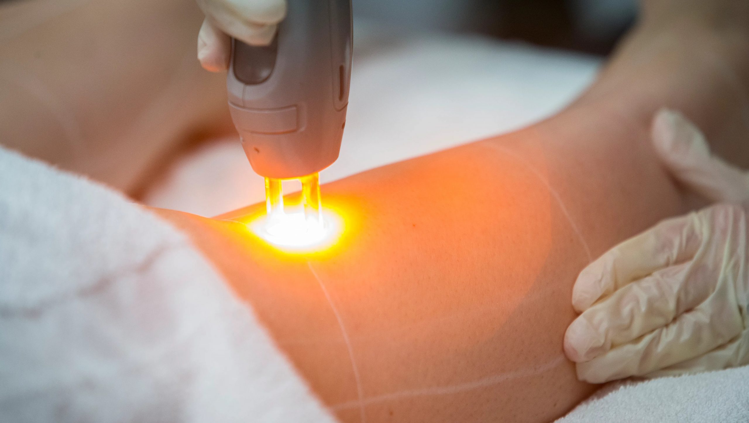 دوره اپراتور لیزر فنی حرفه‌ای